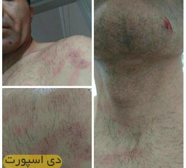 عکس دسته خون