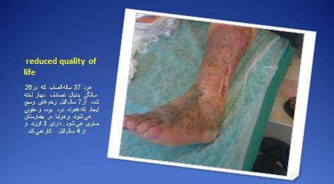 عکس دسته خون