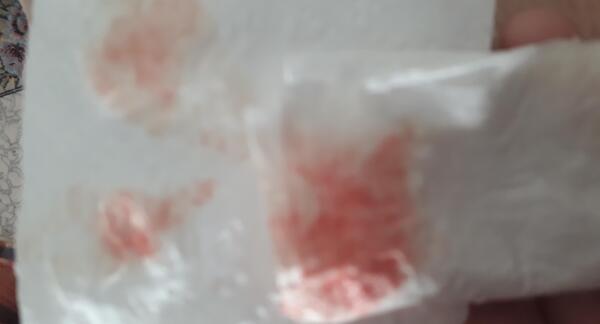 عکس دسته خون
