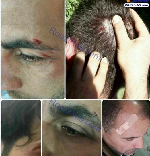 عکس دسته شکسته