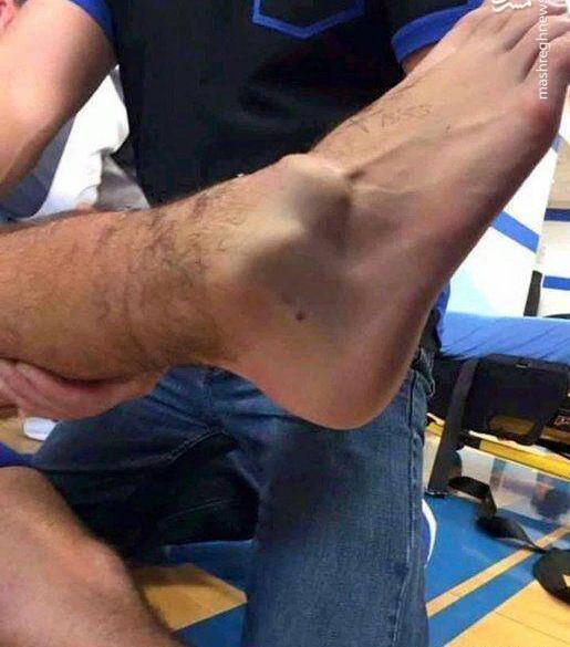 عکس دسته شکسته