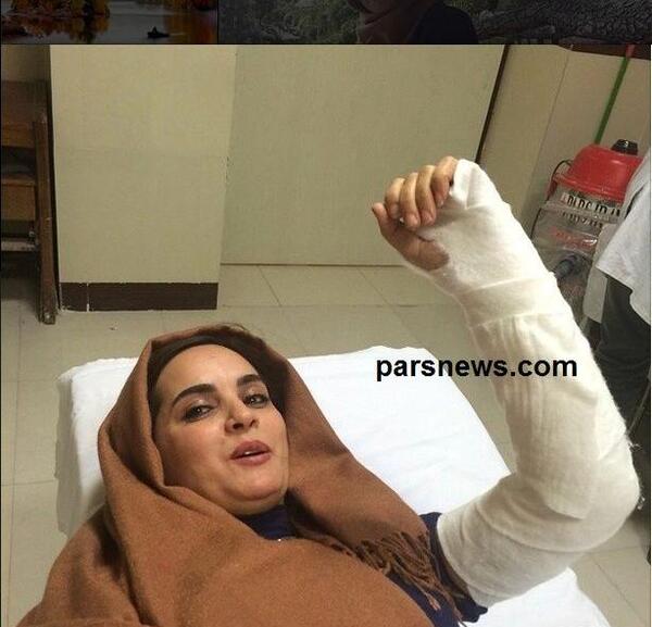 عکس دسته شکسته دختر