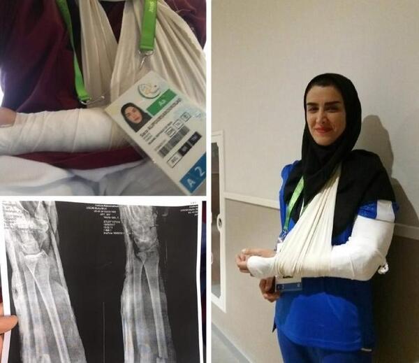 عکس دسته شکسته دختر