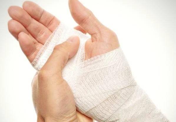 عکس دسته شکسته گچ گرفته دختر