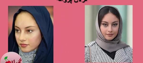 عکس بازیگران ایرانی قبل از عمل زیبایی