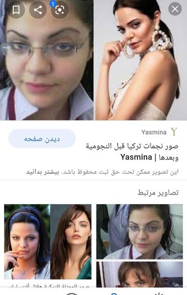 عکس بازیگران ترکی قبل از عمل