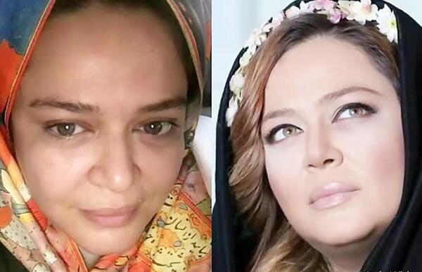 عکس بازیگران قبل از عمل