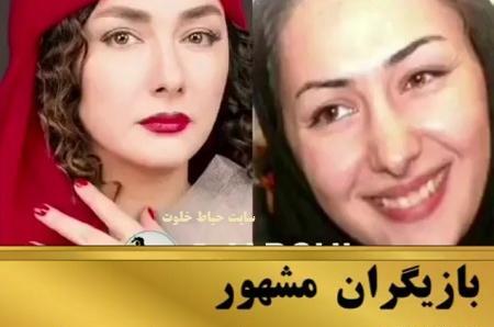 عکس بازیگران قبل از عمل