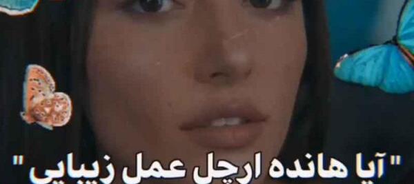 عکس هانده ارچل قبل از عمل زیبایی