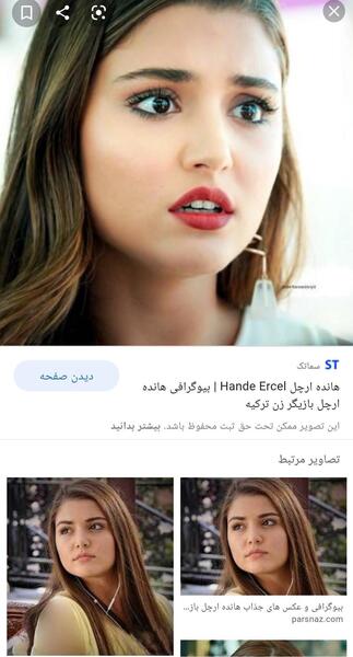 عکس هانده ارچل بعد از عمل زیبایی