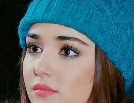عکس هانده ارچل قبل از لاغری