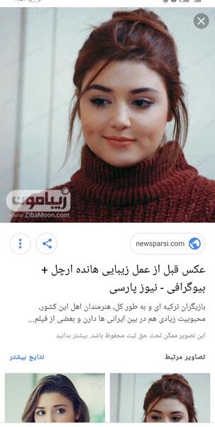 عکس هانده ارچل قبل از لاغری