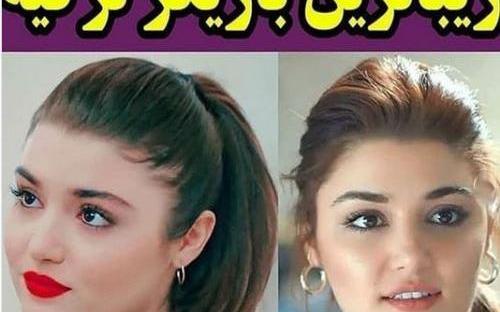 عکس هانده ارچل قبل از لاغری