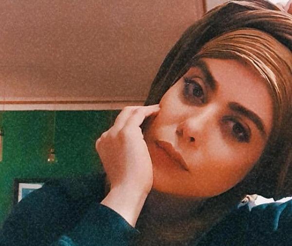 عکس قبل عمل الهام اخوان