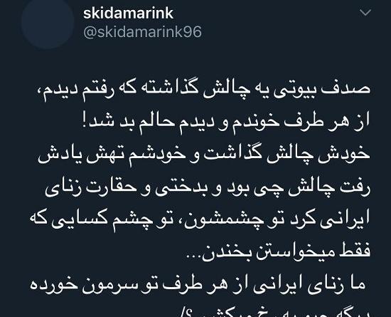 عکس کبودی پای صدف بیوتی