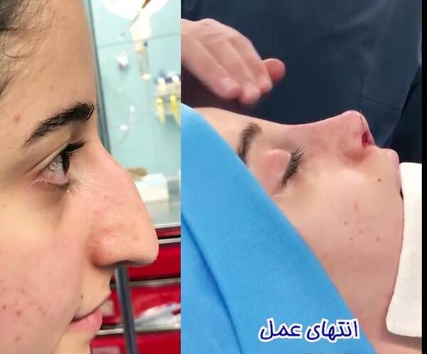 عکس دنیز بایسال بدون گریم