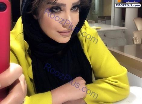 عکس مانتو زرد
