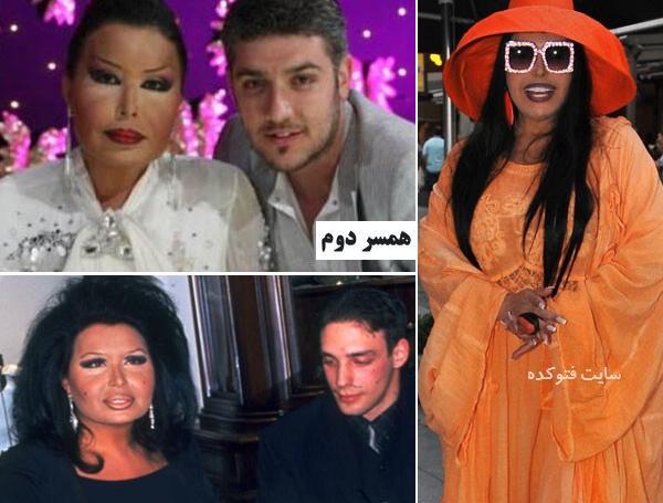 عکس های قبل از عمل بولنت ارسوی