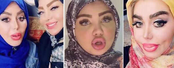 عکس شایان افضلی قبل از عمل