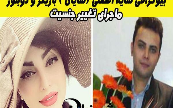 عکس شایان افضلی قبل از عمل