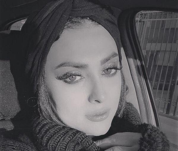 عکس شایان افضلی قبل از عمل