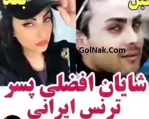 عکس شایان افضلی قبل از عمل