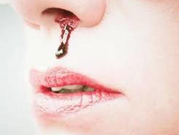 عکس فیک رگ