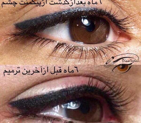 عکس چشم تاتو