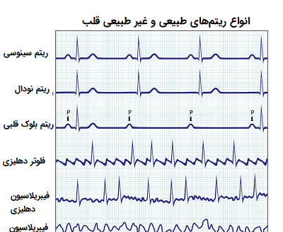 عکس ضربان قلب سالم