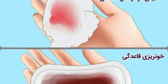 عکس ترشحات بارداری قبل از پریود