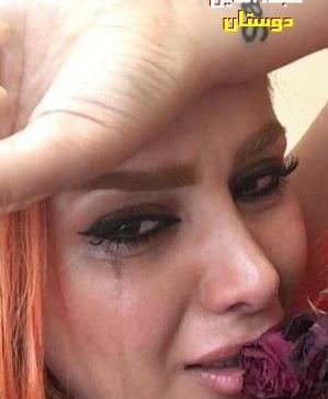 عکس خنده زشت