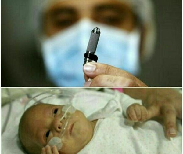 عکس قلب مصنوعی