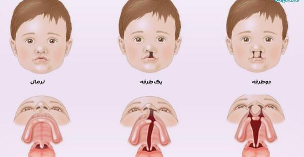 عکس ماه گرفتگی روی دست