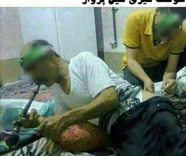 عکس طنز همراه بیمار