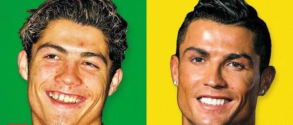 عکس رونالدو قبل از عمل