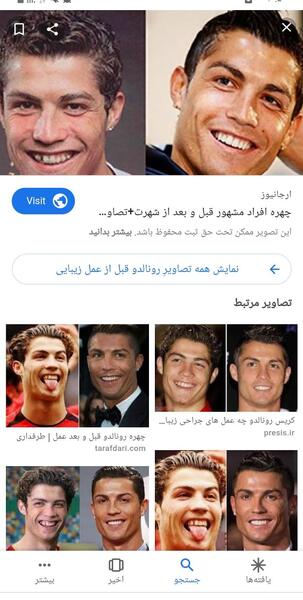 عکس رونالدو قبل از عمل