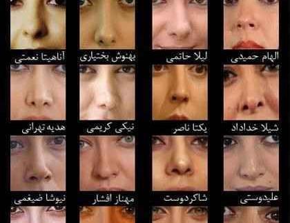عکس دنیز قبل از عمل
