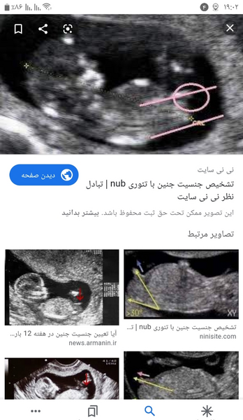 عکس جنین پسر نی نی سایت