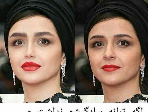 عکس طلا گلزار قبل از عمل