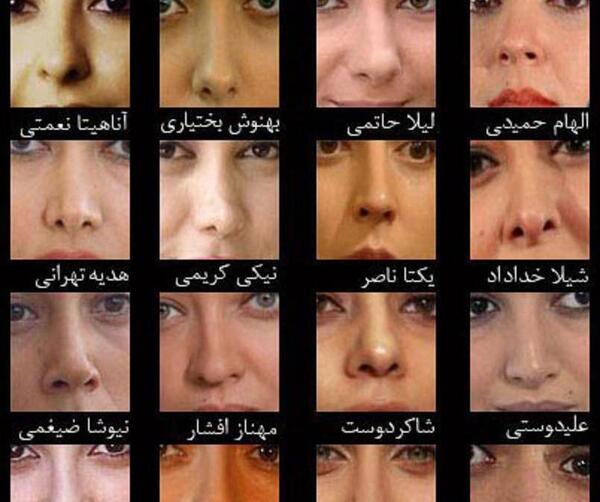 عکس طلا گلزار قبل از عمل