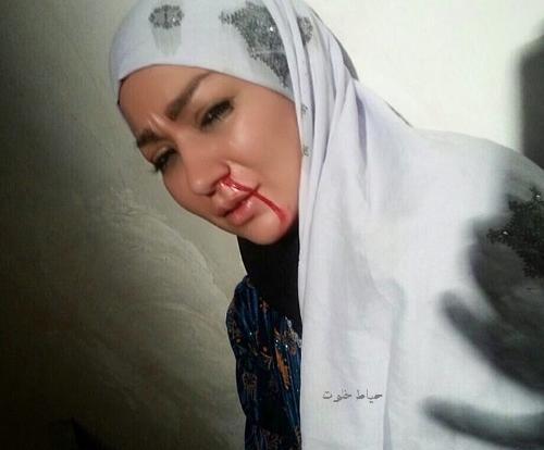 عکس شقایق دلشاد در شهرزاد