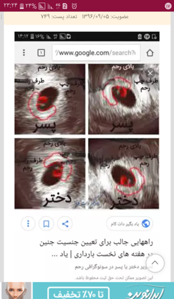 عکس سونوگرافی جنین پسر نی نی سایت