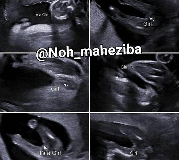 عکس سونوگرافی جنین پسر نی نی سایت