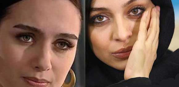 عکس قبل عمل بیرجه آکالای