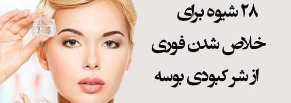 عکس فیک کبودی گردن