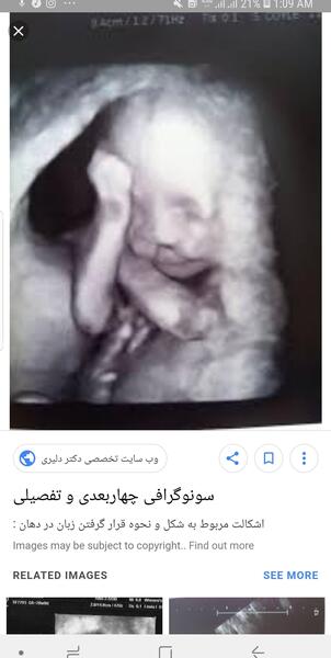 عکس سه بعدی جنین نی نی سایت