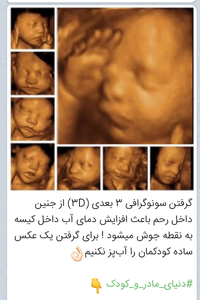 عکس سه بعدی جنین نی نی سایت