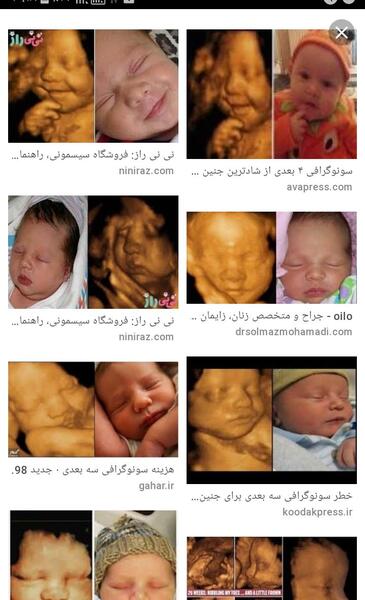 عکس سه بعدی جنین نی نی سایت