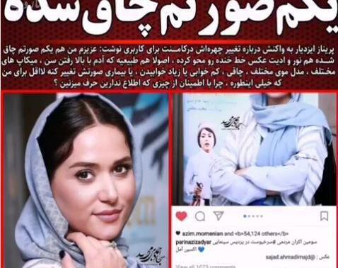 عکس قبل عمل پریناز ایزدیار