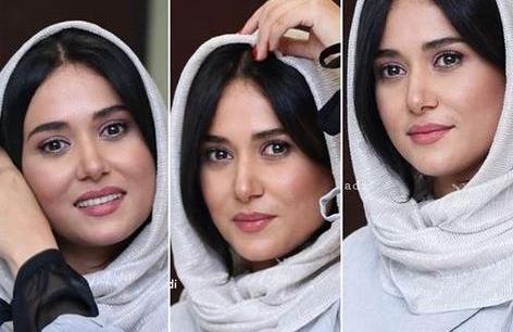 عکس قبل عمل پریناز ایزدیار